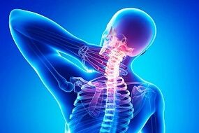 Rückenschmerzen als Symptom einer Osteochondrose