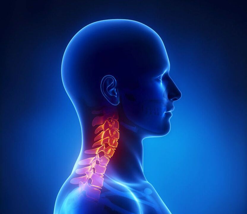 Zervikale Osteochondrose ist eine Pathologie der Wirbelsäule, die Sie zu Hause loswerden können. 