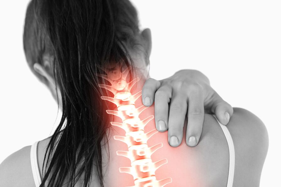 Schmerzen aufgrund einer Osteochondrose der Brustwirbelsäule können bei Frauen in den Nackenbereich ausstrahlen. 